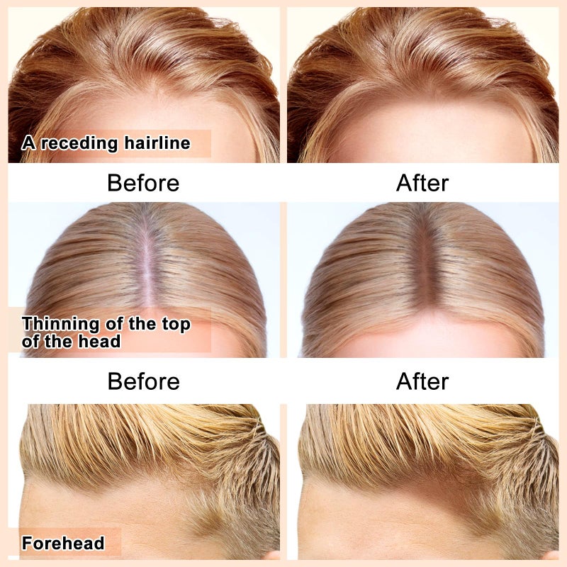 Boobeen Hairline Powder Stick, Hair Shadow Concealer for Thinning Hair, Waterproof Root Touch-Up to Quickly Cover Grey and Conceal Hair Loss - Image 3